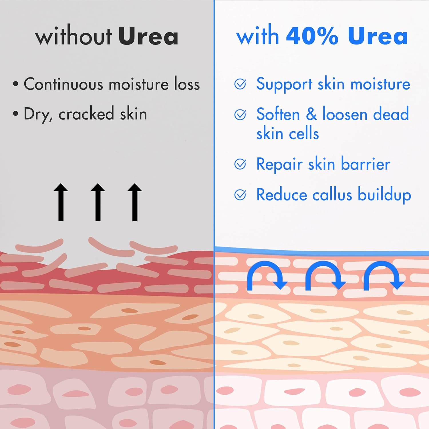 Ebanel Urea Cream Foot Cream for Dry Cracked Heels Feet Knees Elbows Hands, Foot Dead Skin Cuticle - Image 2