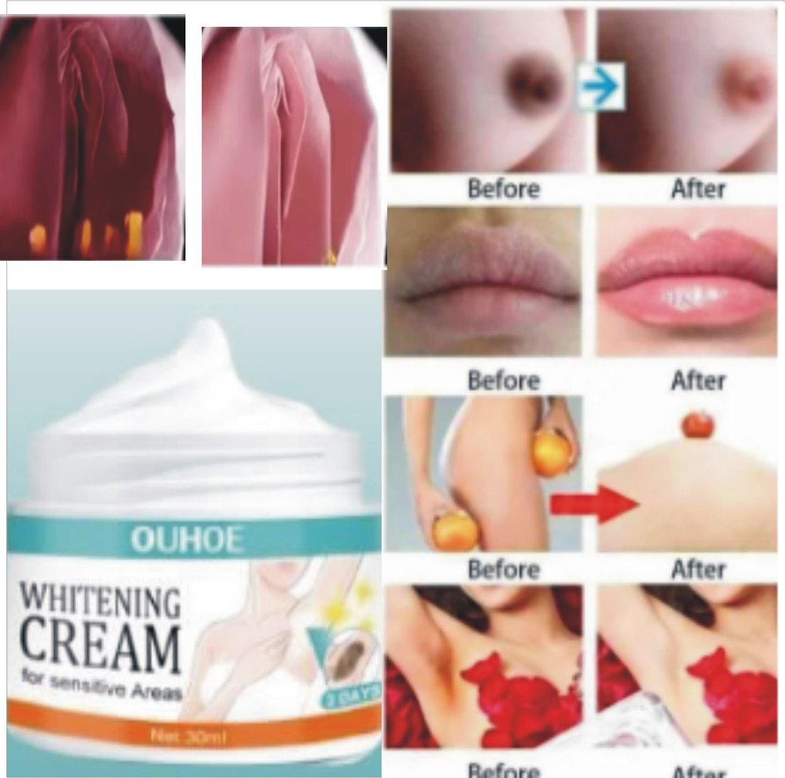 Private Parts Whitening Cream for woman- Brightening Formula, Pack Of 2 - Image 2